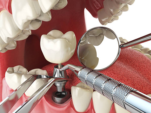 Best Emergency Cosmetic Dentistry in Haverford College, PA